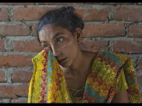 See video